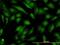 TRC40 antibody, H00000439-M03, Novus Biologicals, Immunocytochemistry image 