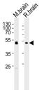 Phosphatidylinositol-5-Phosphate 4-Kinase Type 2 Gamma antibody, MBS9203628, MyBioSource, Western Blot image 