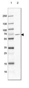 Glutamate Decarboxylase 1 antibody, NBP2-46639, Novus Biologicals, Western Blot image 