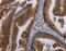 MAGE Family Member B3 antibody, MBS2517973, MyBioSource, Immunohistochemistry frozen image 