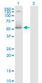 DNA Nucleotidylexotransferase antibody, LS-C197068, Lifespan Biosciences, Western Blot image 
