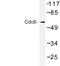 Cell Division Cycle 6 antibody, LS-C176858, Lifespan Biosciences, Western Blot image 