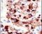 Ubiquitin A-52 Residue Ribosomal Protein Fusion Product 1 antibody, PA5-11325, Invitrogen Antibodies, Immunohistochemistry paraffin image 