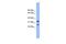 Fc Fragment Of IgE Receptor Ia antibody, GTX46570, GeneTex, Western Blot image 