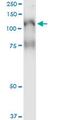 Phospholipase C Like 2 antibody, MA5-21431, Invitrogen Antibodies, Immunoprecipitation image 