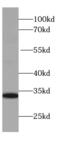 Interferon Lambda 2 antibody, FNab04262, FineTest, Western Blot image 