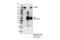 Collagen Type III Alpha 1 Chain antibody, 30565S, Cell Signaling Technology, Immunoprecipitation image 