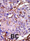 Calcium/Calmodulin Dependent Serine Protein Kinase antibody, abx033234, Abbexa, Immunohistochemistry frozen image 