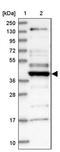 Coiled-Coil Domain Containing 34 antibody, PA5-58016, Invitrogen Antibodies, Western Blot image 