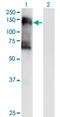 Serine/threonine-protein kinase SIK2 antibody, MA5-21433, Invitrogen Antibodies, Western Blot image 