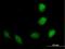 Tripartite Motif Containing 40 antibody, H00135644-B01P, Novus Biologicals, Immunocytochemistry image 