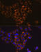 Caspase 6 antibody, GTX01097, GeneTex, Immunocytochemistry image 