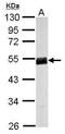 WD Repeat And FYVE Domain Containing 1 antibody, GTX123058, GeneTex, Western Blot image 