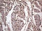 Meis Homeobox 1 antibody, LS-C792156, Lifespan Biosciences, Immunohistochemistry paraffin image 