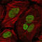 MutL Homolog 1 antibody, abx012221, Abbexa, Enzyme Linked Immunosorbent Assay image 