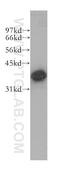 Crystallin Mu antibody, 12495-1-AP, Proteintech Group, Western Blot image 