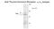 Thyroid Hormone Receptor Alpha antibody, GTX30162, GeneTex, Western Blot image 