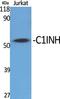 Plasma protease C1 inhibitor antibody, A01221, Boster Biological Technology, Western Blot image 