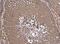Nicotinamide Phosphoribosyltransferase antibody, NBP2-19467, Novus Biologicals, Immunohistochemistry paraffin image 