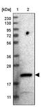 Coiled-Coil Domain Containing 25 antibody, PA5-54735, Invitrogen Antibodies, Western Blot image 
