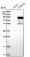 Cysteine And Serine Rich Nuclear Protein 2 antibody, PA5-53822, Invitrogen Antibodies, Western Blot image 