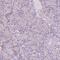 Alpha-1,4-N-Acetylglucosaminyltransferase antibody, PA5-52503, Invitrogen Antibodies, Immunohistochemistry paraffin image 