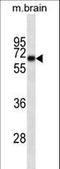 Internexin Neuronal Intermediate Filament Protein Alpha antibody, LS-C165235, Lifespan Biosciences, Western Blot image 