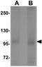 Dispatched RND Transporter Family Member 3 antibody, GTX32048, GeneTex, Western Blot image 