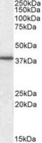 F11 Receptor antibody, TA305723, Origene, Western Blot image 