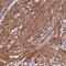 Coiled-Coil Domain Containing 102B antibody, PA5-59229, Invitrogen Antibodies, Immunohistochemistry paraffin image 