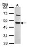 Ubl carboxyl-terminal hydrolase 18 antibody, PA5-27849, Invitrogen Antibodies, Western Blot image 