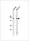 Hexosaminidase Subunit Beta antibody, 61-180, ProSci, Western Blot image 