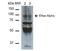 Sodium Channel Epithelial 1 Beta Subunit antibody, NBP2-59382, Novus Biologicals, Western Blot image 