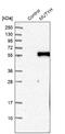 MutY DNA Glycosylase antibody, NBP1-87743, Novus Biologicals, Western Blot image 