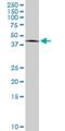 Phosphatidylinositol Transfer Protein Beta antibody, H00023760-M05, Novus Biologicals, Western Blot image 