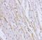 Nuclear Receptor Subfamily 3 Group C Member 1 antibody, LS-C344086, Lifespan Biosciences, Immunohistochemistry paraffin image 