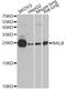 RAS Like Proto-Oncogene B antibody, A4069, ABclonal Technology, Western Blot image 