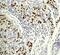 p53 antibody, ab32049, Abcam, Immunohistochemistry paraffin image 