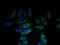 KH Domain Containing 1 antibody, A65138-100, Epigentek, Immunofluorescence image 