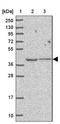 Transmembrane Protein 121 antibody, NBP2-14693, Novus Biologicals, Western Blot image 