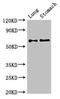 Glutamate Decarboxylase 2 antibody, CSB-PA11159A0Rb, Cusabio, Western Blot image 