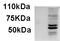 Absent In Melanoma 2 antibody, EB09874, Everest Biotech, Western Blot image 