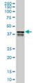 Poly(RC) Binding Protein 2 antibody, H00005094-M06, Novus Biologicals, Western Blot image 