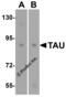 PHF-tau antibody, 8077, ProSci Inc, Western Blot image 