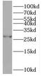 Thiamin Pyrophosphokinase 1 antibody, FNab08888, FineTest, Western Blot image 