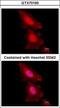 Forkhead Box O1 antibody, GTX70193, GeneTex, Immunocytochemistry image 