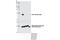 Cellular Retinoic Acid Binding Protein 1 antibody, 13163S, Cell Signaling Technology, Western Blot image 