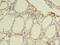 Toll Like Receptor 6 antibody, CSB-PA023605LA01HU, Cusabio, Immunohistochemistry frozen image 