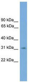 Sprouty RTK Signaling Antagonist 3 antibody, TA339690, Origene, Western Blot image 