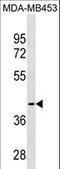 Kynurenine Aminotransferase 1 antibody, LS-C159277, Lifespan Biosciences, Western Blot image 